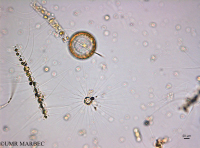 phyto/Guinea golf/Wouri_estuary_ZD-ZD1-ZD2-ZD3/YNkouefuthNfongmo_these 2022-2023/Corethron sp (ZD1_SURF_2023_grandsoleil230621_001_ovl).TIF(copy)_thumb.jpg